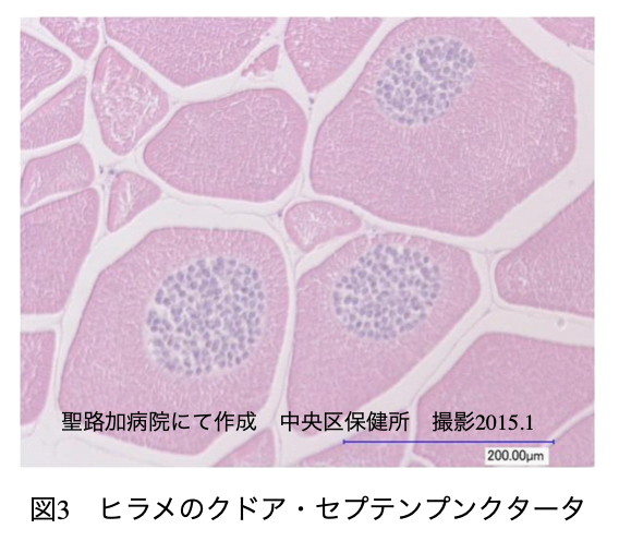 図3：ヒラメのクドア・セプテンプンクタータ